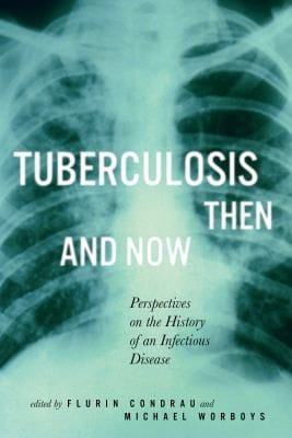 Tuberculosis Then And Now Perspectives On The Hisotry Of An Infectious Disease
