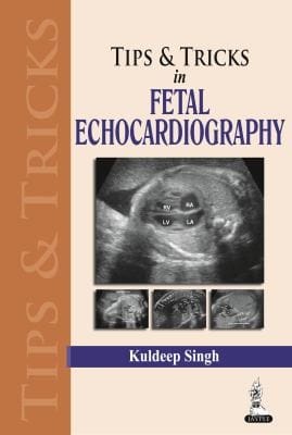 Tips  Tricks in Fetal Echocardiography