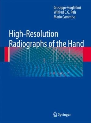 Highresolution Radiographs Of The Hand