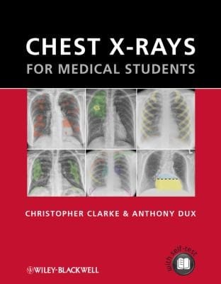 Chest Xrays For Medical Students