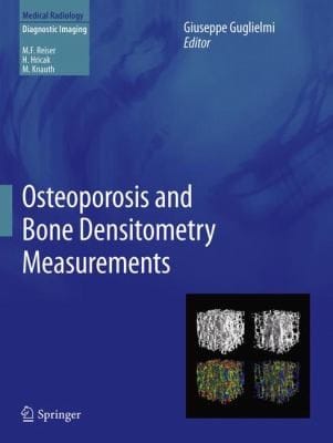 Osteoporosis And Bone Densitometry Measurements