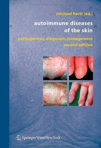 Autoimmune Diseases of the Skin: Pathogenesis, Diagnosis, Management