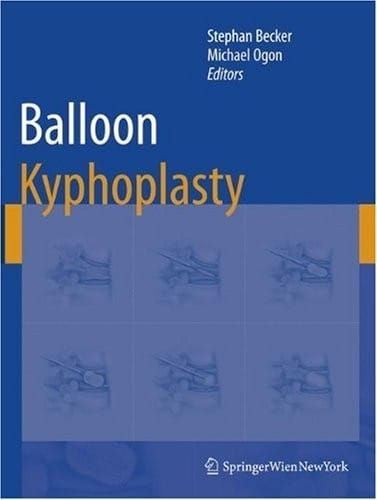 Balloon Kyphoplasty