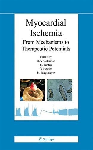 Myocardial Ischemia: From Mechanisms to Therapeutic Potentials (Basic Science for the Cardiologist Book 21)
