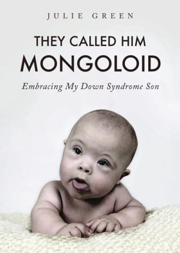 They Called Him Mongoloid