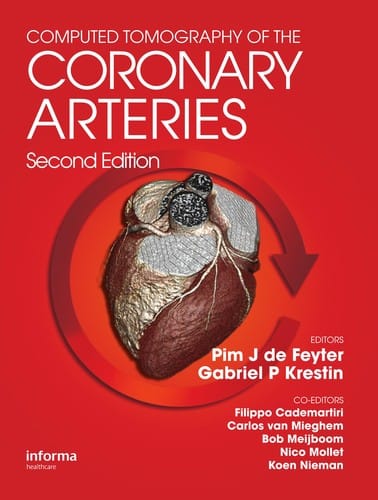 Computed tomography of the coronary arteries