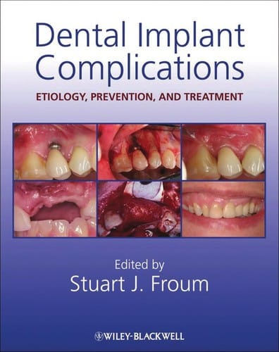 Dental implant complications