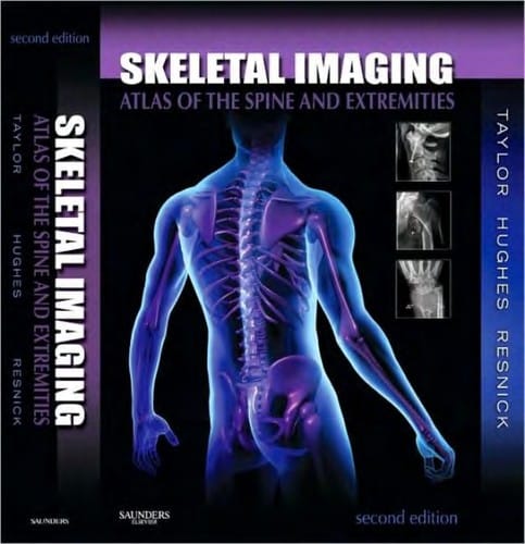 Skeletal imaging