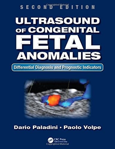 Ultrasound of Congenital Fetal Anomalies: Differential Diagnosis and Prognostic Indicators, Second Edition