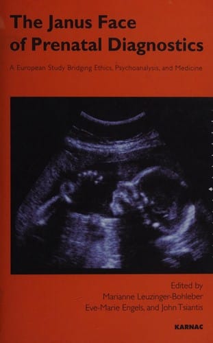 The Janus face of prenatal diagnostics