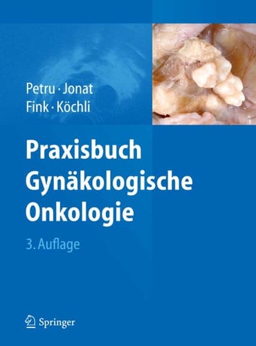 Praxisbuch Gyna kologische Onkologie