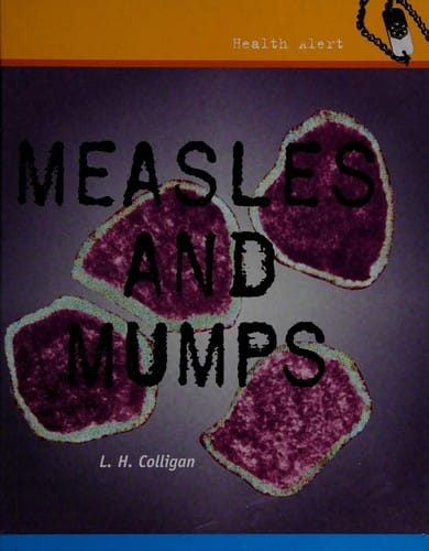 Measles and mumps