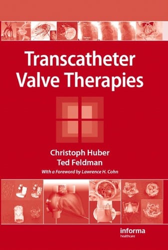 Transcatheter valve therapies