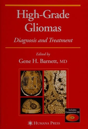 High-grade gliomas