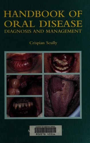 Handbook of oral disease