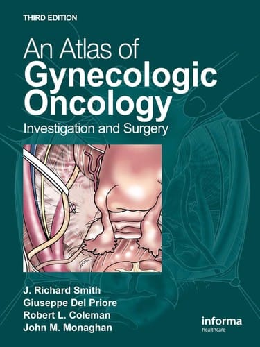An atlas of gynecologic oncology