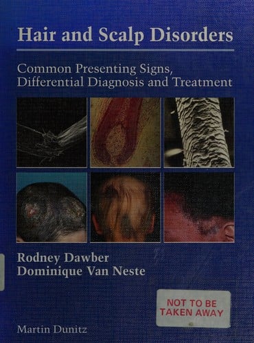 Hair and scalp disorders: common presenting signs, differential diagnosis, and treatment