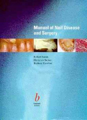 Diseases of the nails and their management