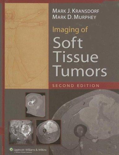 Imaging of soft tissue tumors
