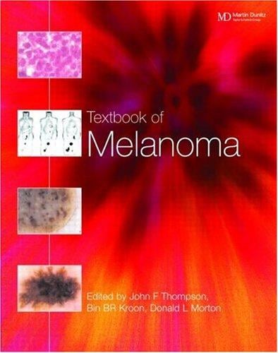 Textbook of Melanoma