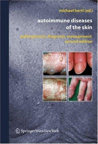 Autoimmune Diseases of the Skin: Pathogenesis, Diagnosis, Management