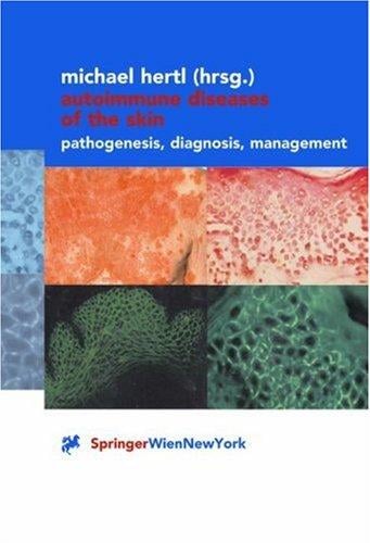 Autoimmune Diseases of the Skin: Pathogenesis, Diagnosis, Management