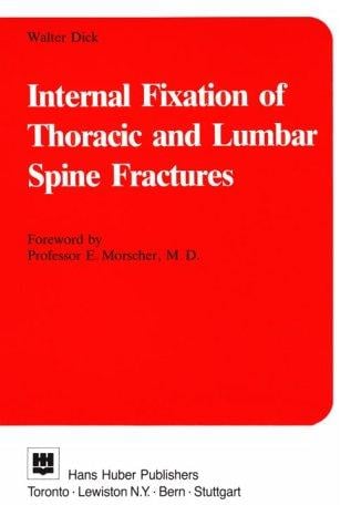 Internal fixation of thoracic and lumbar spine fractures