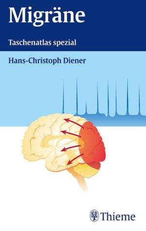 Migräne. Taschenatlas spezial.