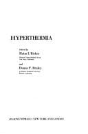 Hyperthermia