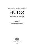 Hudø: Bilder fra en barndom