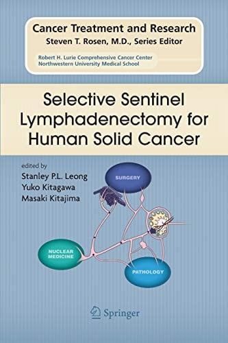 Selective Sentinel Lymphadenectomy for Human Solid Cancer