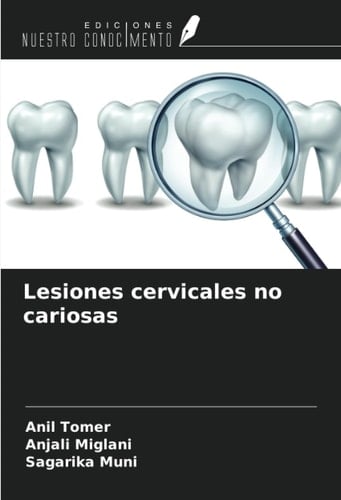 Lesiones cervicales no cariosas (Spanish Edition)