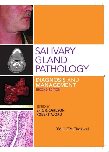 Salivary Gland Pathology Diagnosis and Management