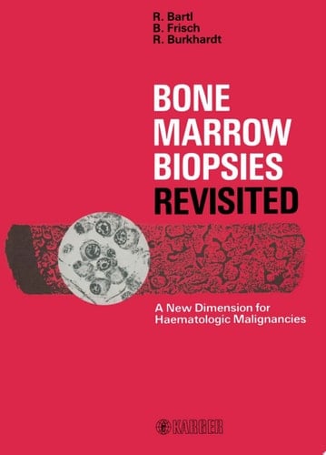Bone Marrow Biopsies Revisited A New Dimension for Hematologic Malignancies