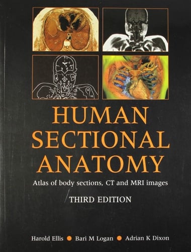 Human Sectional Anatomy: Atlas of Body Sections, CT and MRI Images, Third Edition