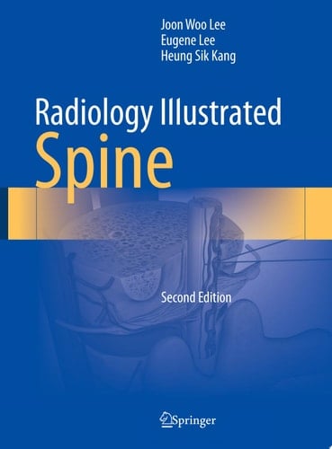 Radiology Illustrated: Spine