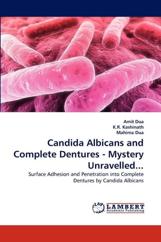 Candida Albicans and Complete Dentures - Mystery Unravelled