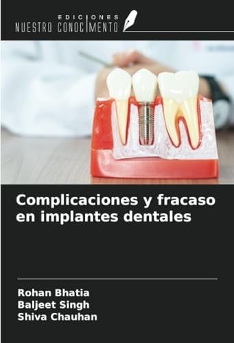 Complicaciones y fracaso en implantes dentales (Spanish Edition)