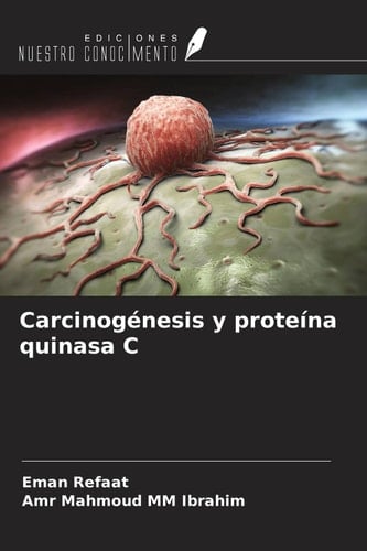 Carcinogénesis y proteína quinasa C (Spanish Edition)