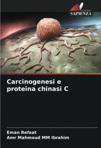 Carcinogenesi e proteina chinasi C (Italian Edition)