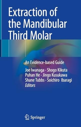 Extraction of the Mandibular Third Molar An Evidence-based Guide