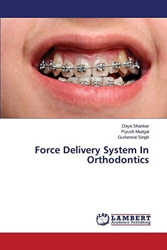 Force Delivery System In Orthodontics