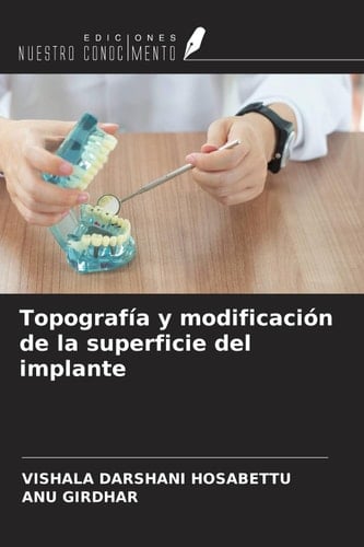 Topografía y modificación de la superficie del implante (Spanish Edition)