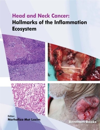 Head and Neck Cancer: Hallmarks of The Inflammation Ecosystem-Volume 2