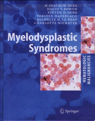 Myelodysplastic Syndromes