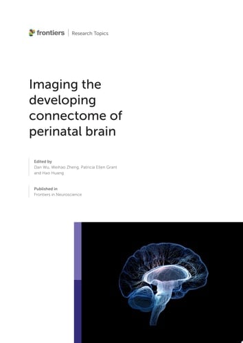 Imaging the Developing Connectome of Perinatal Brain