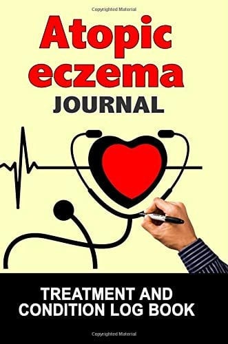 Atopic Eczema Journal Treatment and Condition Log Book, 150 College-Ruled Pages