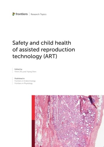 Safety and child health of assisted reproduction technology (ART)