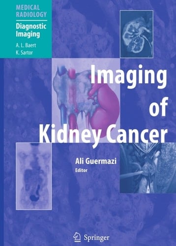 Imaging of Kidney Cancer