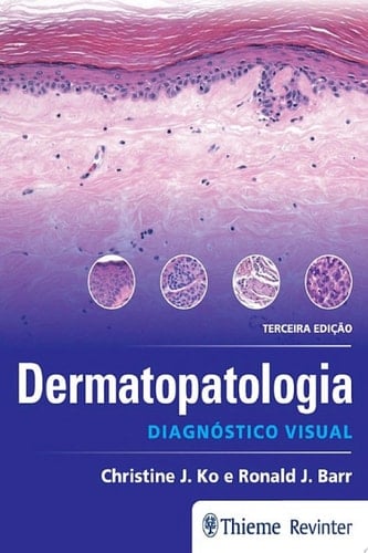 Dermatopatologia: Diagnóstico Visual